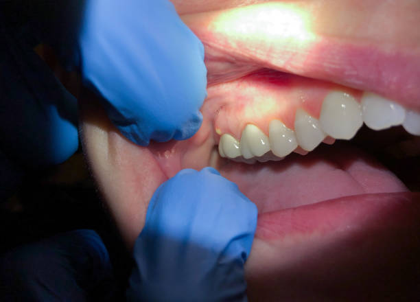 Dentist for Dental Trauma in OK