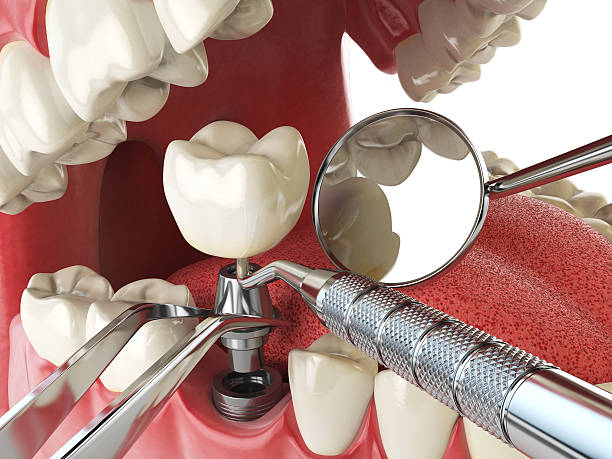 Best Knocked-Out Tooth Emergency  in Tuttle, OK